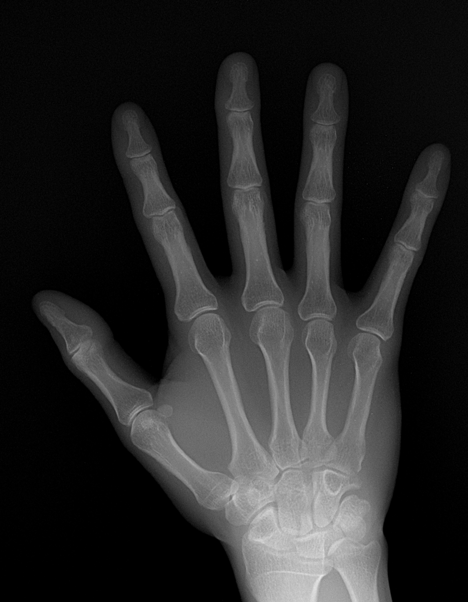2015.8.6 update 手根骨のＸ線写真 